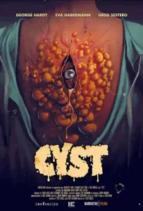 Киста (фильм 2020)